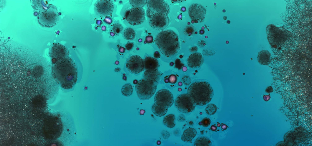 Infection Control & Biofilm Proactive Management Solution